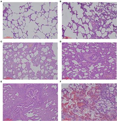 Deprivation of Dietary Fiber Enhances Susceptibility of Piglets to Lung Immune Stress